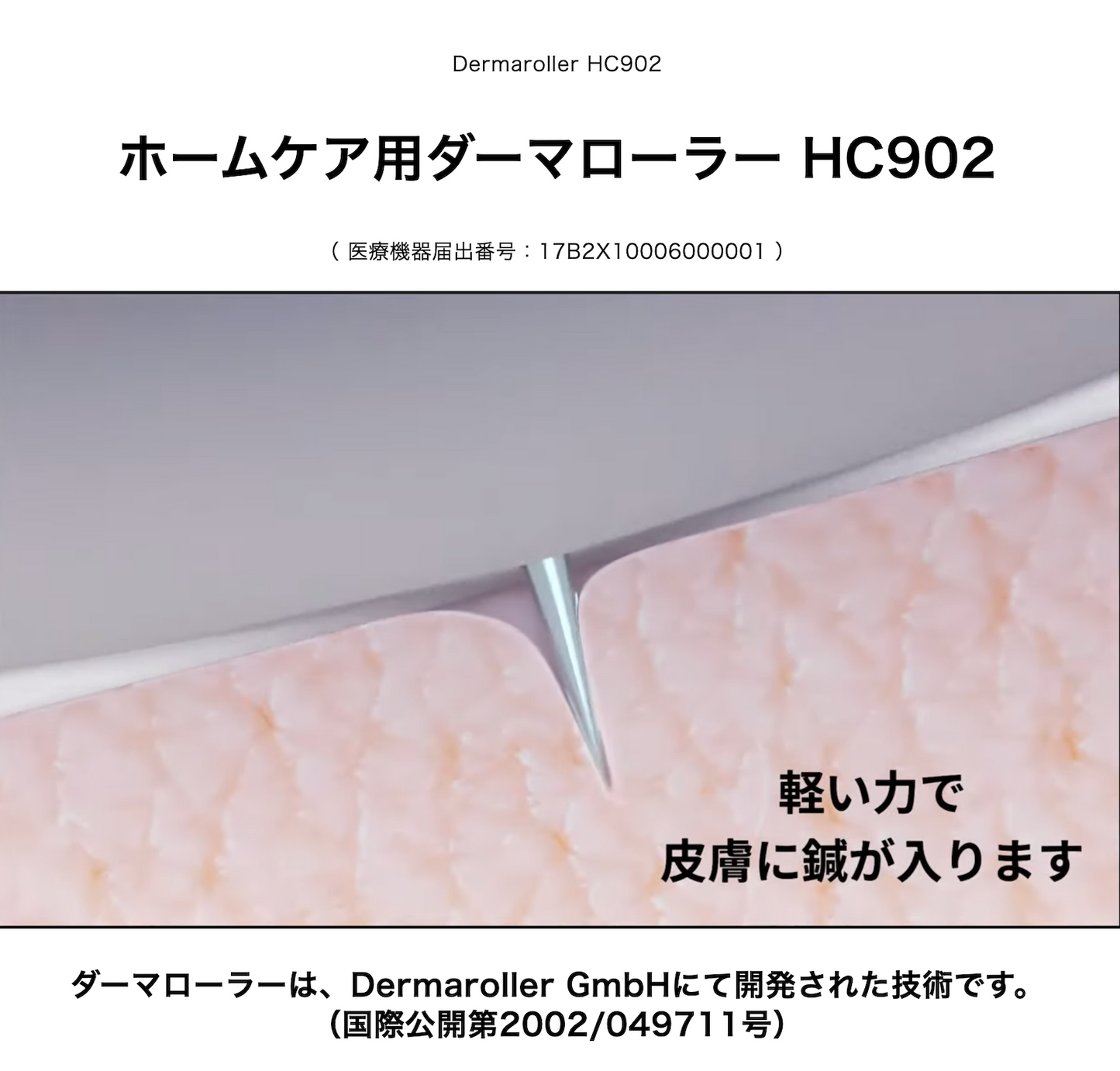 ダーマローラー hc902 正規 ドイツ 医療 美顔器 シミ 色素沈着 美容鍼 鍼灸